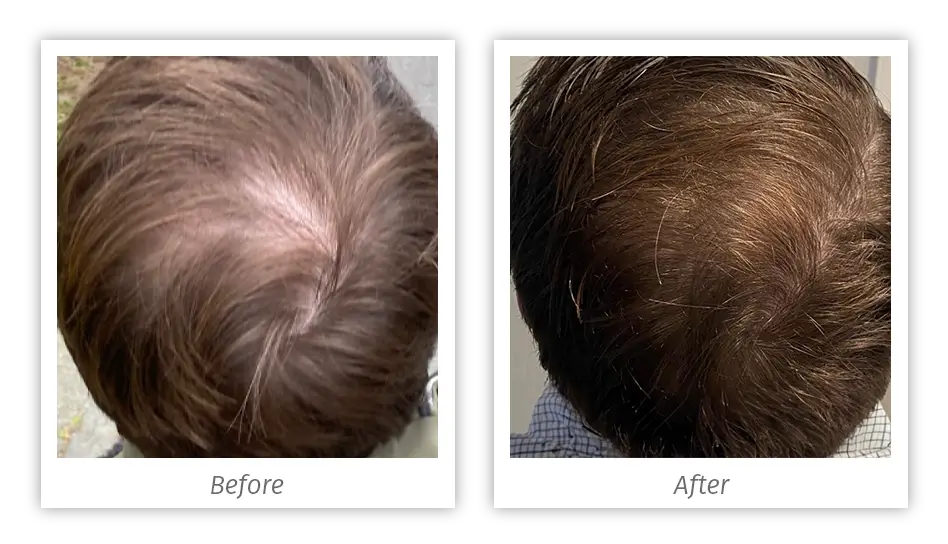 Antes&Depois-01