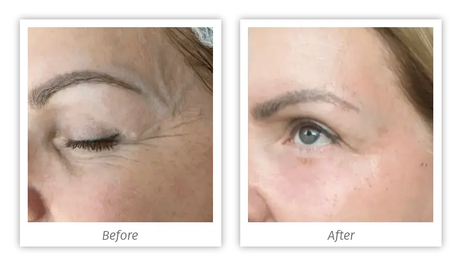Antes&Depois-02