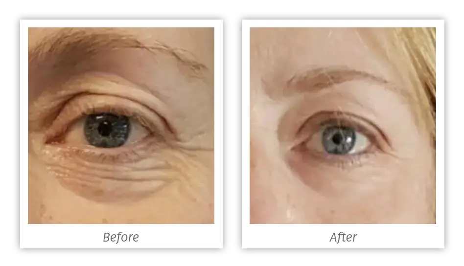 Antes&Depois-03