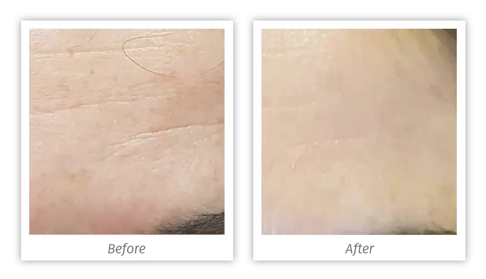 Antes&Depois-04