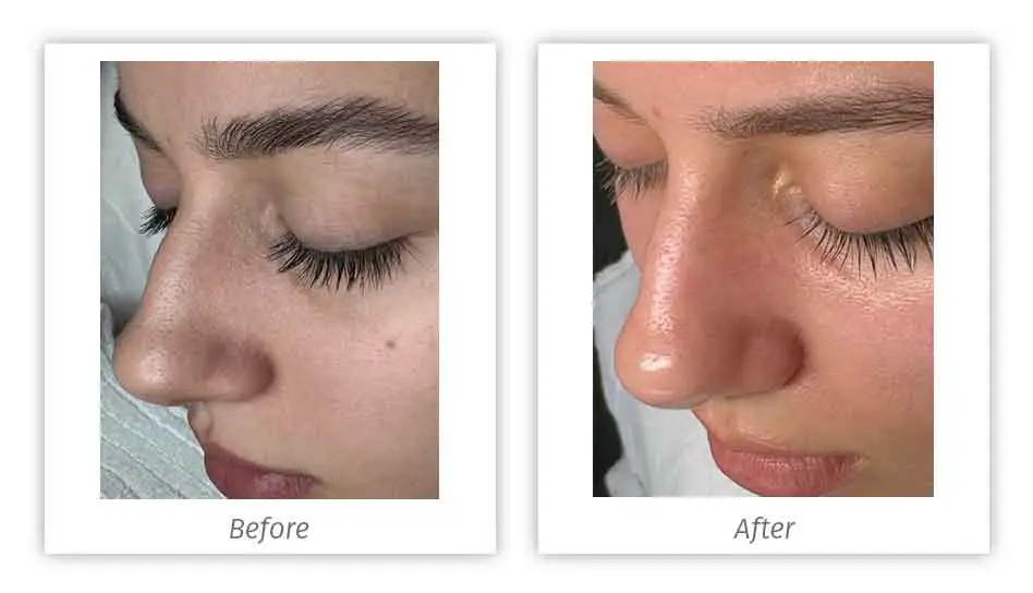Antes&Depois-05