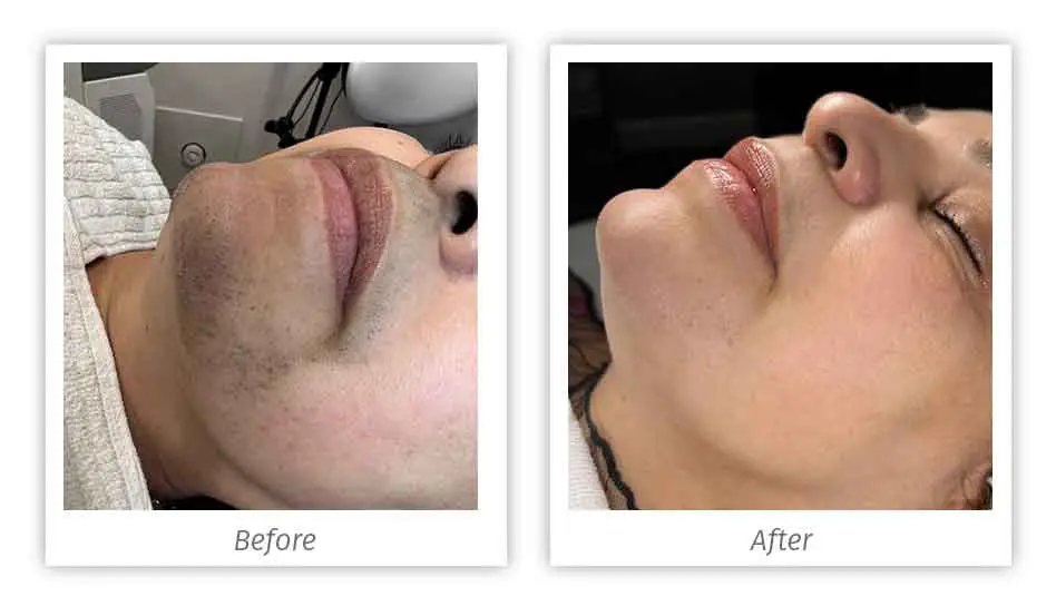 Antes&Depois-06