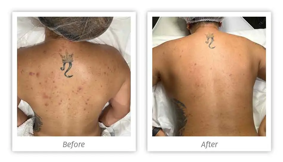 Antes&Depois-07
