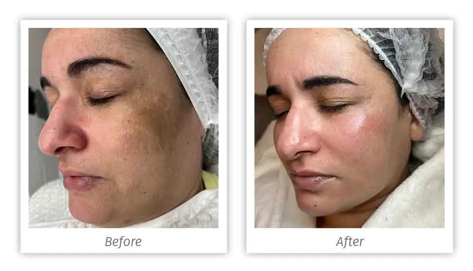 Antes&Depois-08