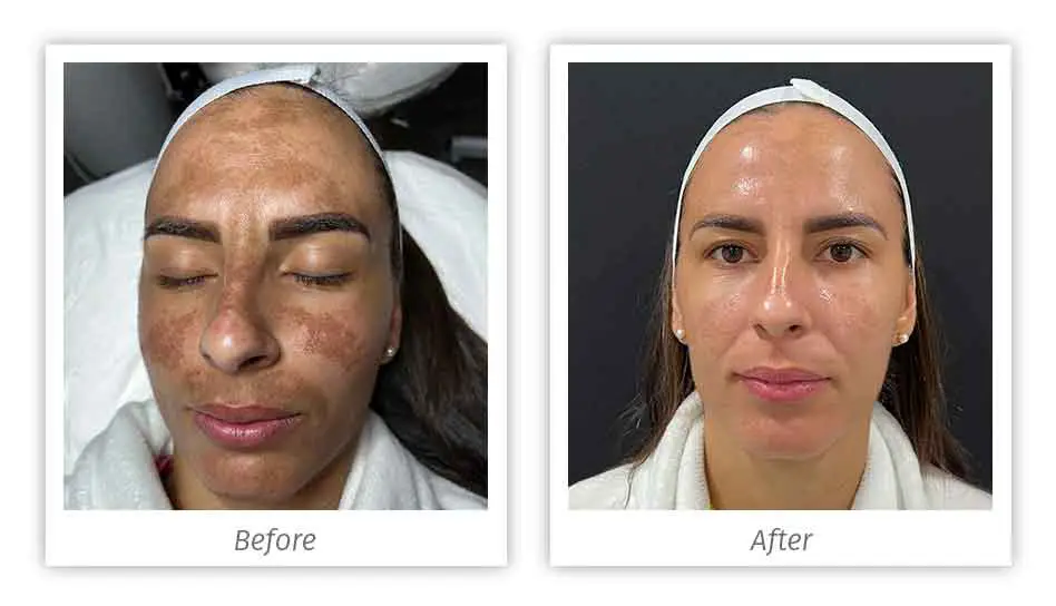 Antes&Depois-09