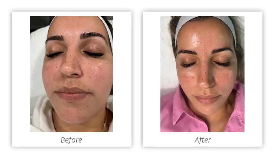 Antes&Depois-10