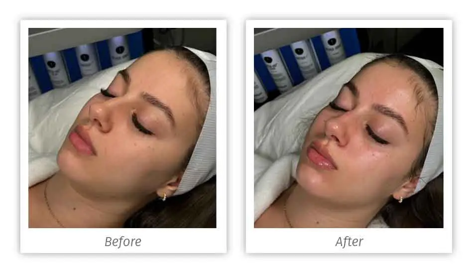 Antes&Depois-11