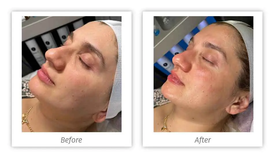Antes&Depois-12