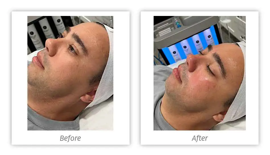 Antes&Depois-13