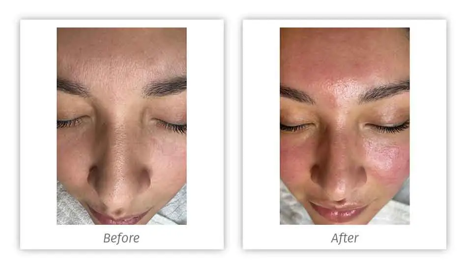 Antes&Depois-14