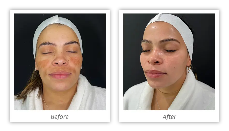 Antes&Depois-15